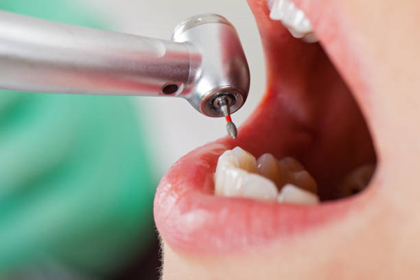 Best Dentist for Tooth Abscess  in Caldwell, ID